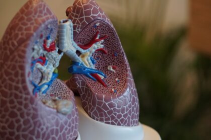 Međunarodni dan borbe protiv opstruktivne bolesti pluća