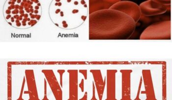 types of anemia