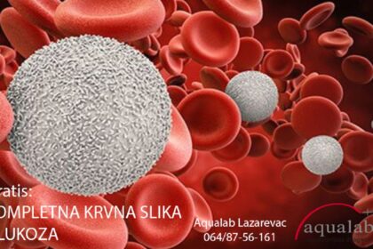 Aqualab Lazarevac
