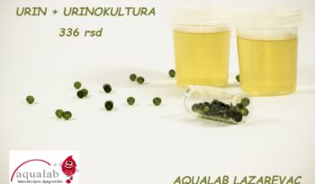 URIN I URINOKULTURA