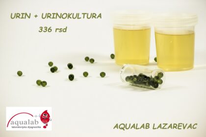 URIN I URINOKULTURA