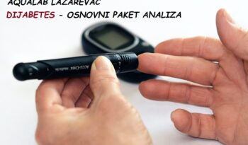 Analize Lazarevac