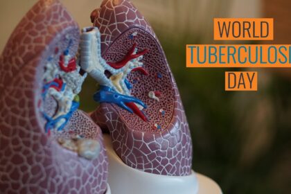 Svetski dan borbe protiv tuberkuloze