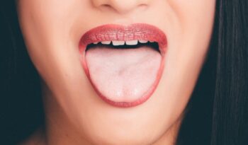 how to treat candida
